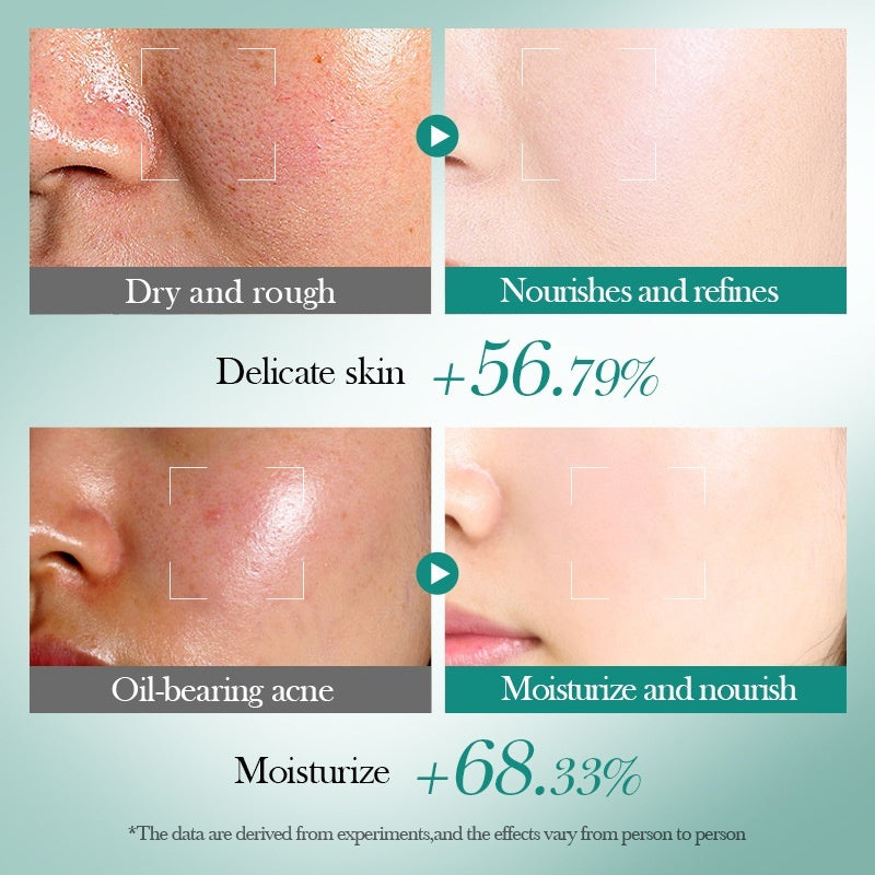 Hyaluronic Acid Moisturizing Repair Firming Skin Care Gift Box